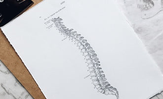 Bad posture. postural kyphosis, hunched back